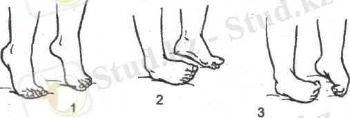 Почему ребенок ходит на носочках: каковы причины и что делать