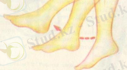 D:\Суреттер Әлемі\Көрнекілікке арналған\Биологиялық\АНАТОМИЯ\IV тару ЖҮЙКЕ ЖҮЙЕСІНЕ ЖАЛПЫ ШОЛУ\АНАТОМИЯ 024 - копия.jpg