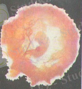 D:\Суреттер Әлемі\Көрнекілікке арналған\Биологиялық\АНАТОМИЯ\XIV тарау АДАМНЫҢ КӨБЕЮІ МЕН ДАМУЫ\АНАТОМИЯ 079 - копия.jpg